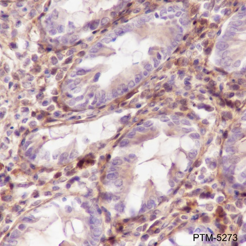 Anti-Galectin-1 Rabbit mAb