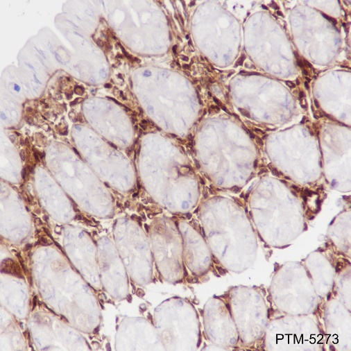 Anti-Galectin-1 Rabbit mAb