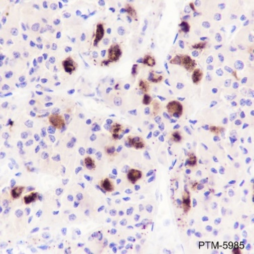 Anti-Luteinizing Hormone beta Rabbit mAb