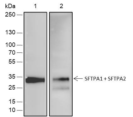 Anti-SFTPA1 + SFTPA2 Rabbit mAb
