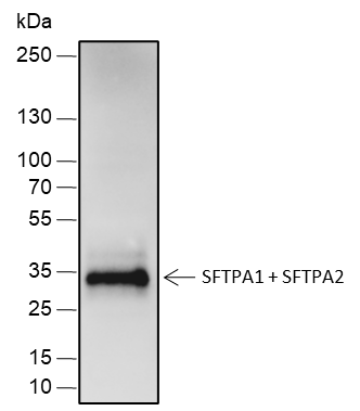 Anti-SFTPA1 + SFTPA2 Rabbit mAb