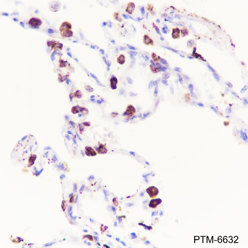 Anti-SFTPA1 + SFTPA2 Rabbit mAb
