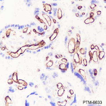 Anti-CD32B Rabbit mAb