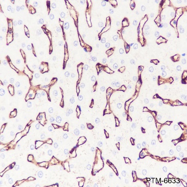 Anti-CD32B Rabbit mAb