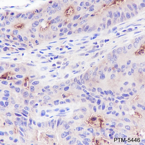 Anti-CEACAM1 Rabbit mAb