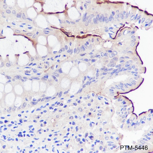 Anti-CEACAM1 Rabbit mAb