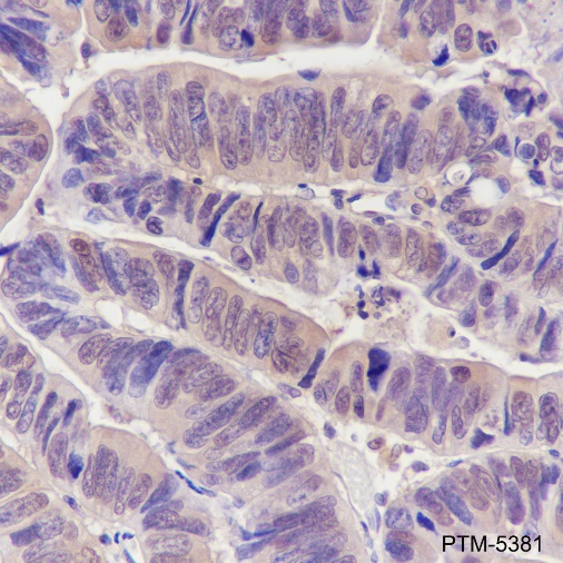Anti-Galectin-3 Mouse mAb