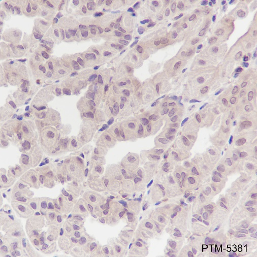 Anti-Galectin-3 Mouse mAb