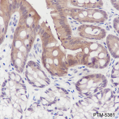 Anti-Galectin-3 Mouse mAb