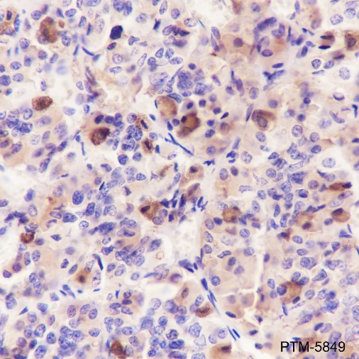Anti-Luteinizing Hormone beta Rabbit mAb