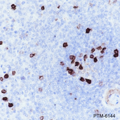 Anti-CD57 Mouse mAb