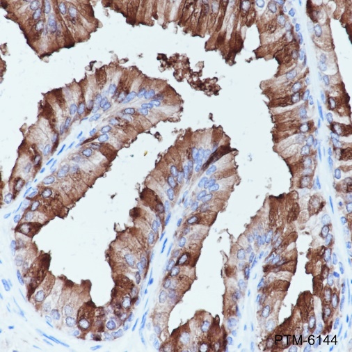 Anti-CD57 Mouse mAb