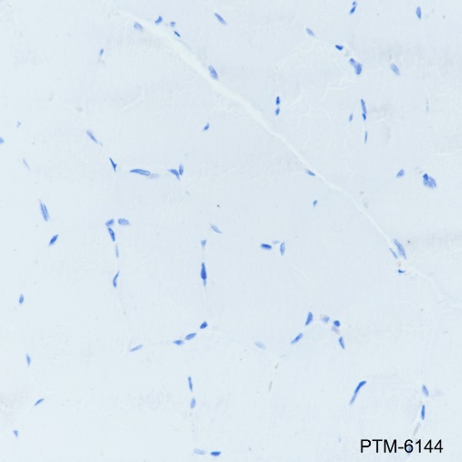 Anti-CD57 Mouse mAb