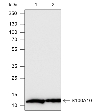 Anti-S100A10 Mouse mAb