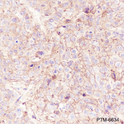 Anti-S100A10 Mouse mAb