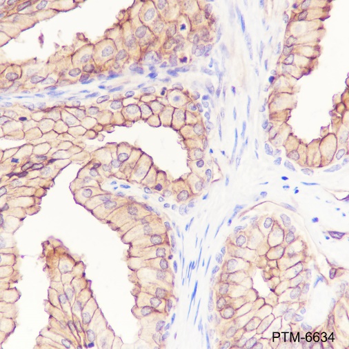 Anti-S100A10 Mouse mAb