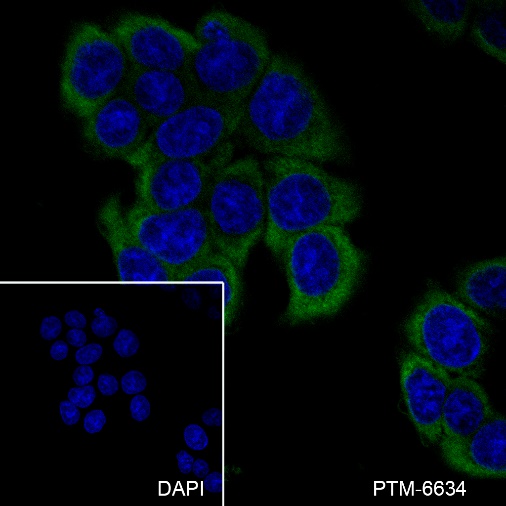 Anti-S100A10 Mouse mAb