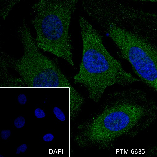 Anti-GSK3 alpha/beta Mouse mAb