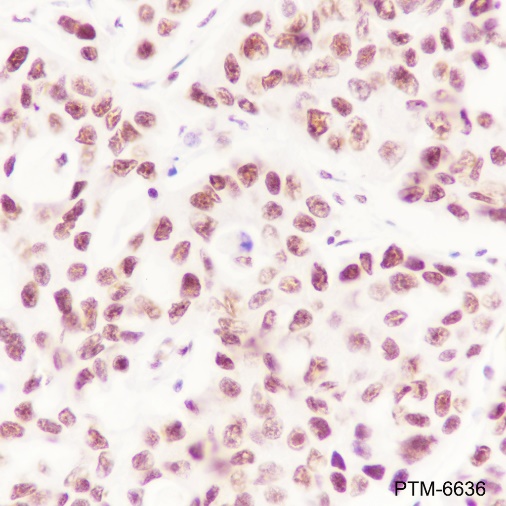 Anti-DHX9 Mouse mAb