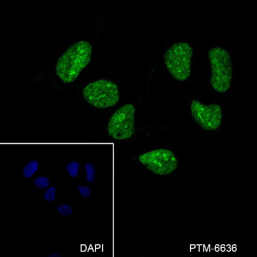 Anti-DHX9 Mouse mAb
