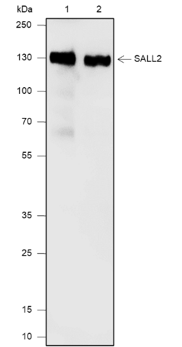 Anti-SALL2 Mouse mAb