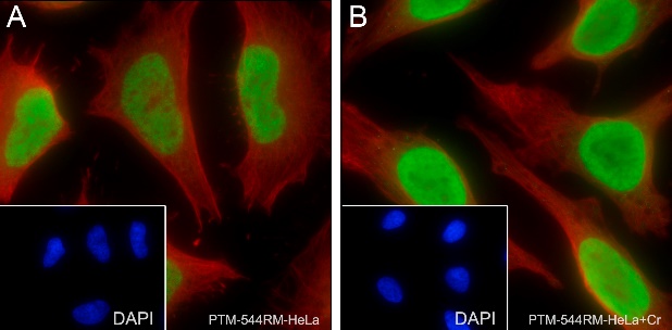 Anti-Crotonyl-histone H3 (Lys18/23) Rabbit mAb