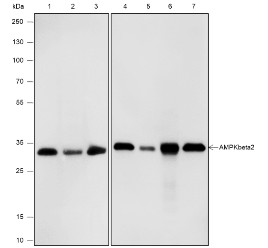 Anti-AMPK beta 2 Mouse mAb