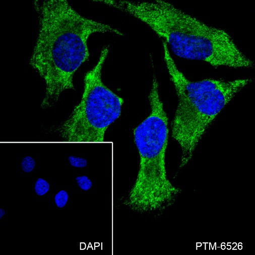 Anti-AMPK beta 2 Mouse mAb
