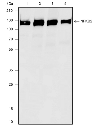 Anti-NF-kB2 p100/p52 Rabbit mAb