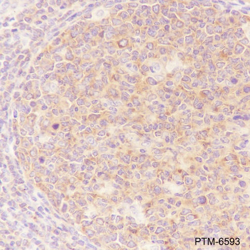 Anti-NF-kB2 p100/p52 Rabbit mAb