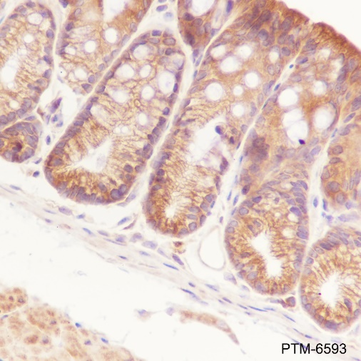 Anti-NF-kB2 p100/p52 Rabbit mAb