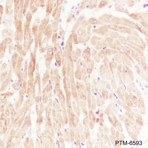 Anti-NF-kB2 p100/p52 Rabbit mAb