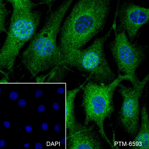 Anti-NF-kB2 p100/p52 Rabbit mAb