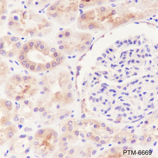 Anti-HDAC6 Rabbit mAb