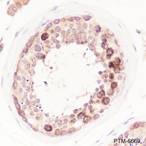 Anti-HDAC6 Rabbit mAb