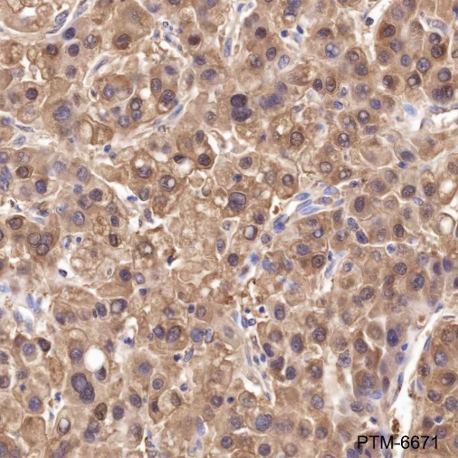 Anti-TXNRD1 Mouse mAb