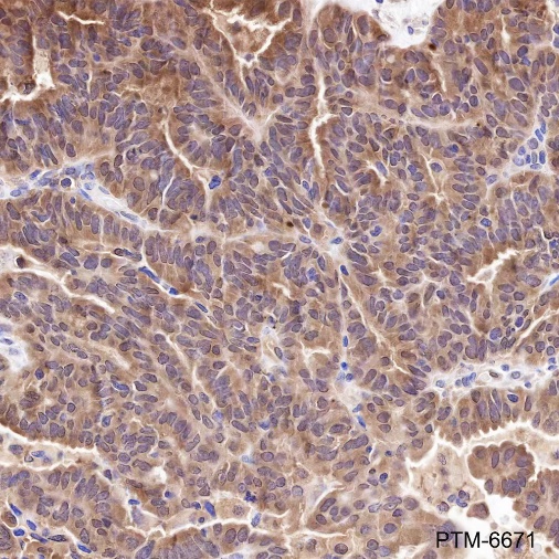 Anti-TXNRD1 Mouse mAb