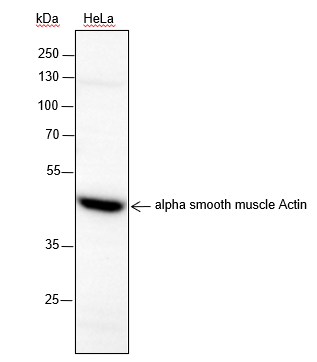Anti-alpha Smooth Muscle Actin Rabbit mAb