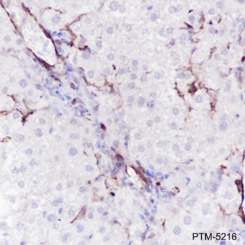 Anti-alpha Smooth Muscle Actin Rabbit mAb