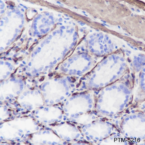 Anti-alpha Smooth Muscle Actin Rabbit mAb