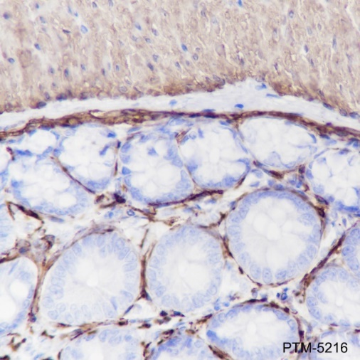 Anti-alpha Smooth Muscle Actin Rabbit mAb