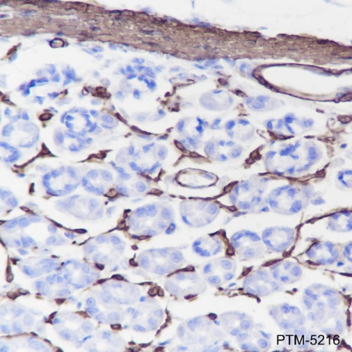 Anti-alpha Smooth Muscle Actin Rabbit mAb