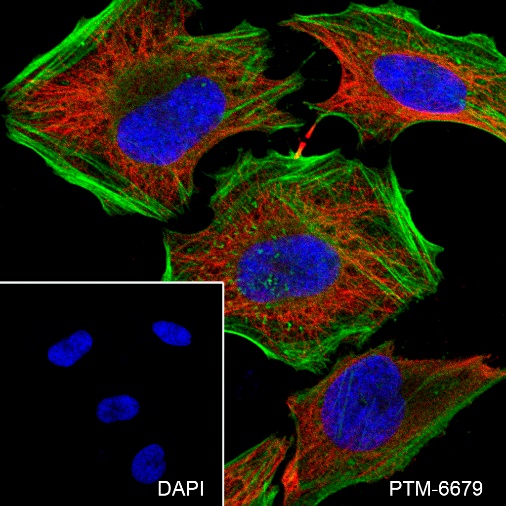 Anti-Gelsolin Rabbit mAb