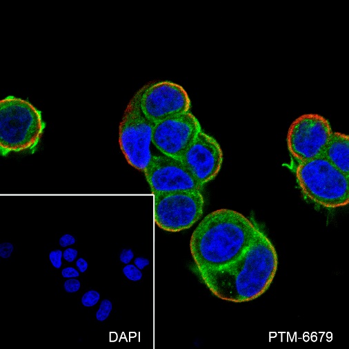 Anti-Gelsolin Rabbit mAb