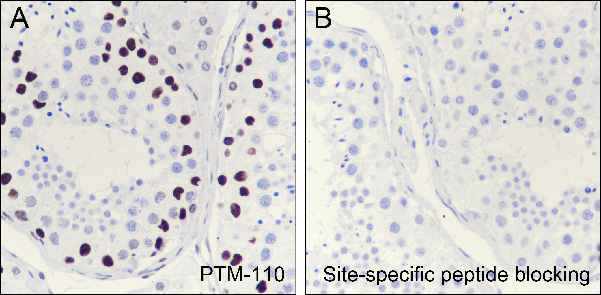Anti-Acetyl-Histone H2B (Lys20) Rabbit pAb