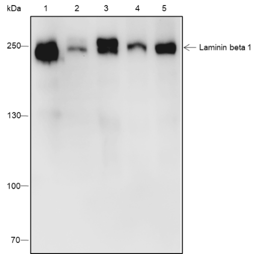 Anti-Laminin beta 1 Rabbit mAb
