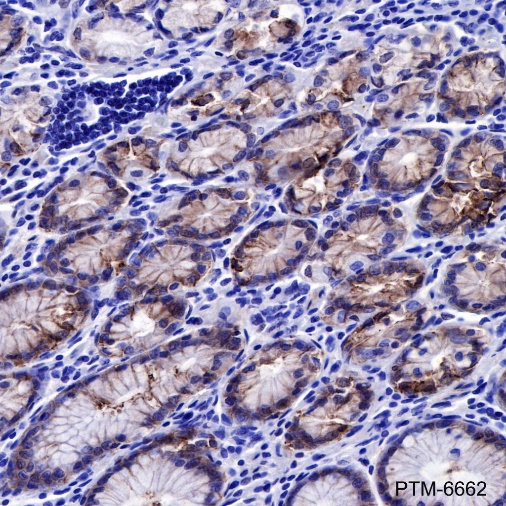 Anti-Claudin-18.2 Rabbit mAb