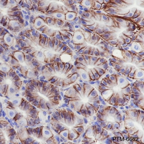 Anti-Claudin-18.2 Rabbit mAb