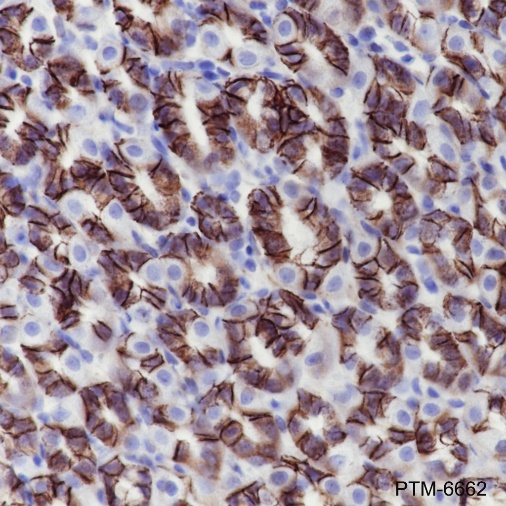 Anti-Claudin-18.2 Rabbit mAb