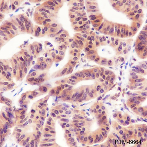 Anti-Cyclin D2 Rabbit mAb